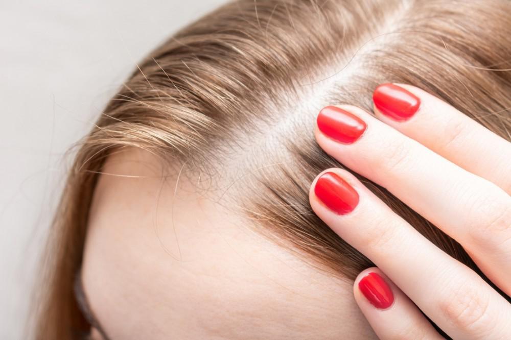 Do Prescription Hair Loss Medications Really Work? Image