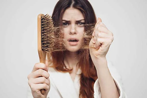 Female Pattern Baldness